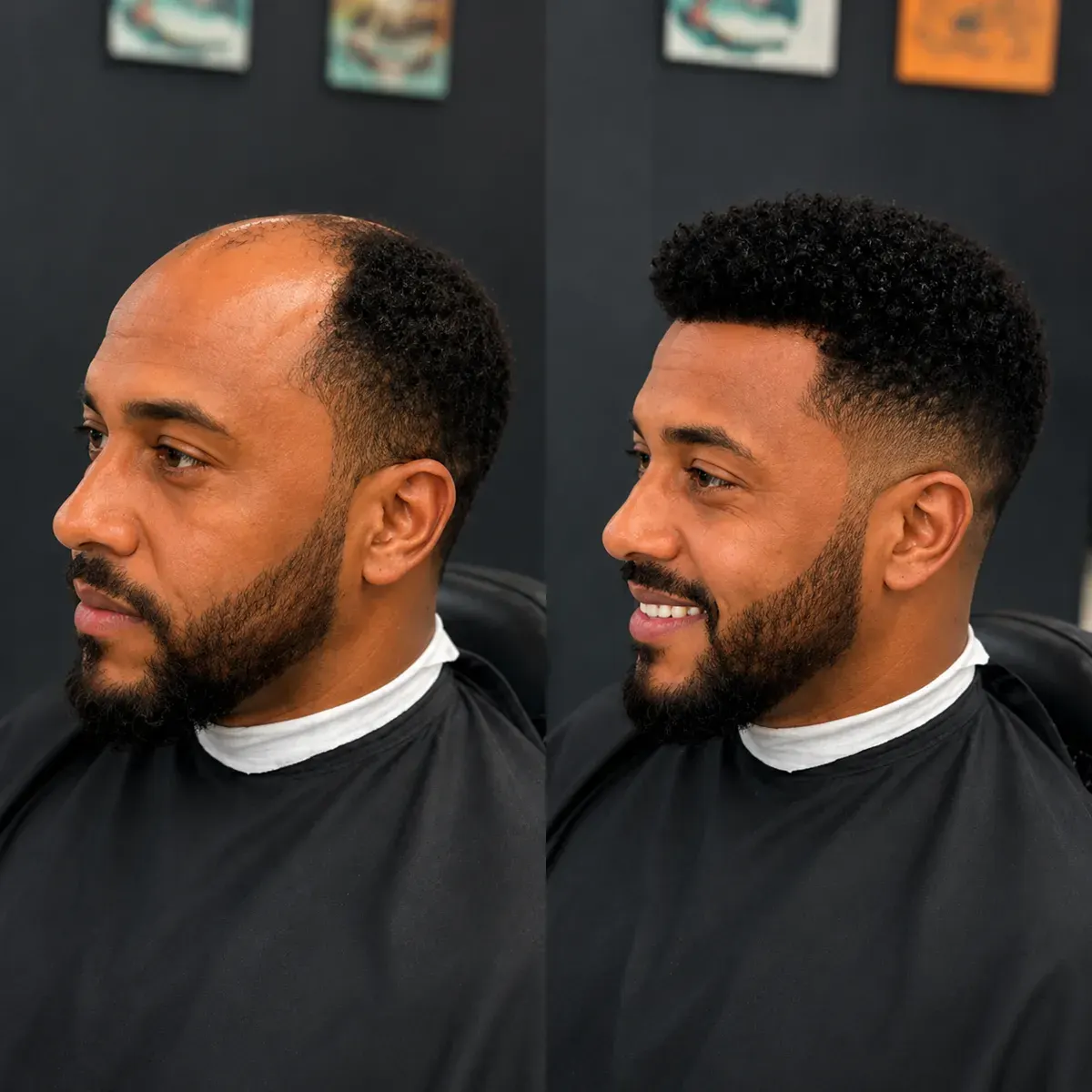 Antes e depois de prótese capilar na Barbearia Executive
